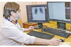 Заболеваемость туберкулезом снижается. но расслабляться не стоит